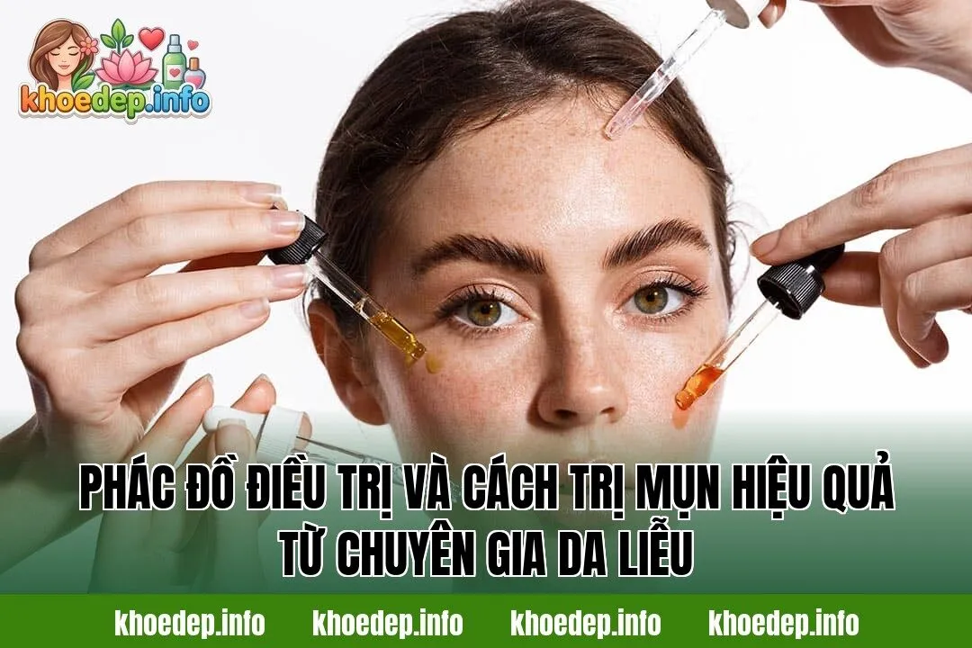 Phác đồ điều trị và cách trị mụn hiệu quả từ chuyên gia da liễu