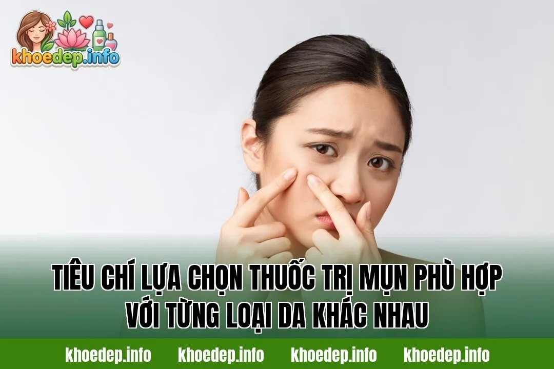 Tiêu chí lựa chọn thuốc trị mụn phù hợp với từng loại da khác nhau