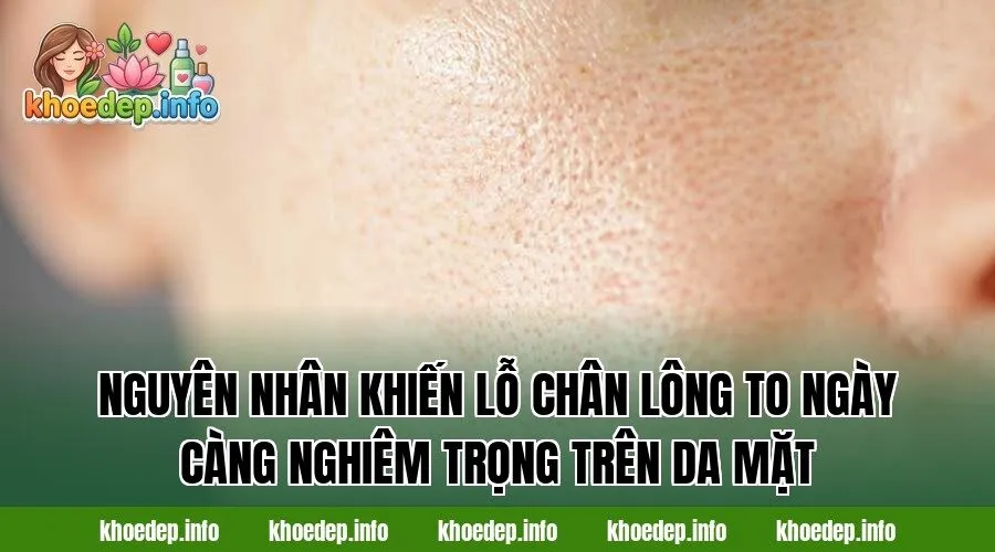 Nguyên nhân khiến lỗ chân lông to ngày càng nghiêm trọng trên da mặt