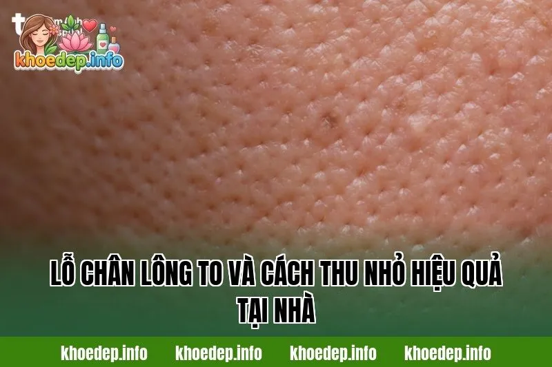 Lỗ chân lông to và cách thu nhỏ hiệu quả tại nhà